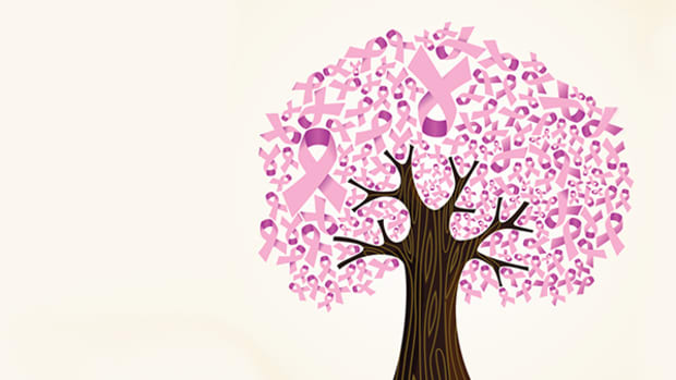 breast-cancer-tree