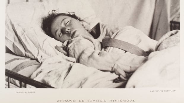 A female patient diagnosed with "sleep hysteria" wearing a straitjacket, 1888.