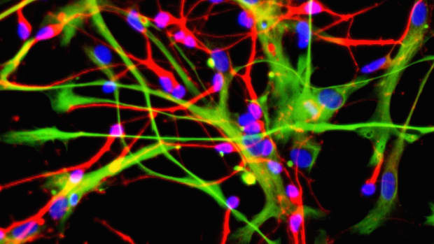 Neurons (red) and astrocytes (green), developed from stem cells.