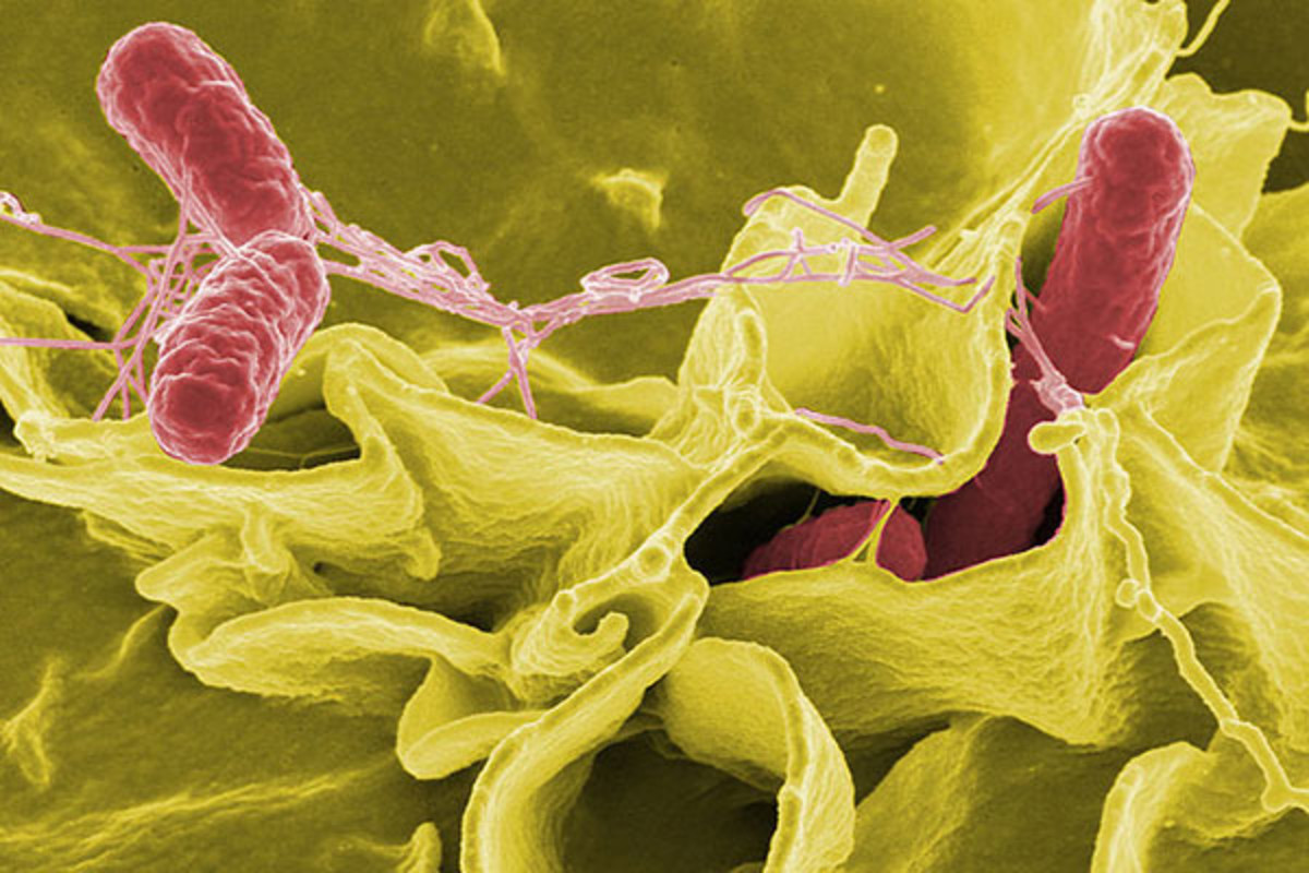 Color-enhanced scanning electron micrograph showing Salmonella typhimurium invading cultured human cells. (PHOTO: PUBLIC DOMAIN)