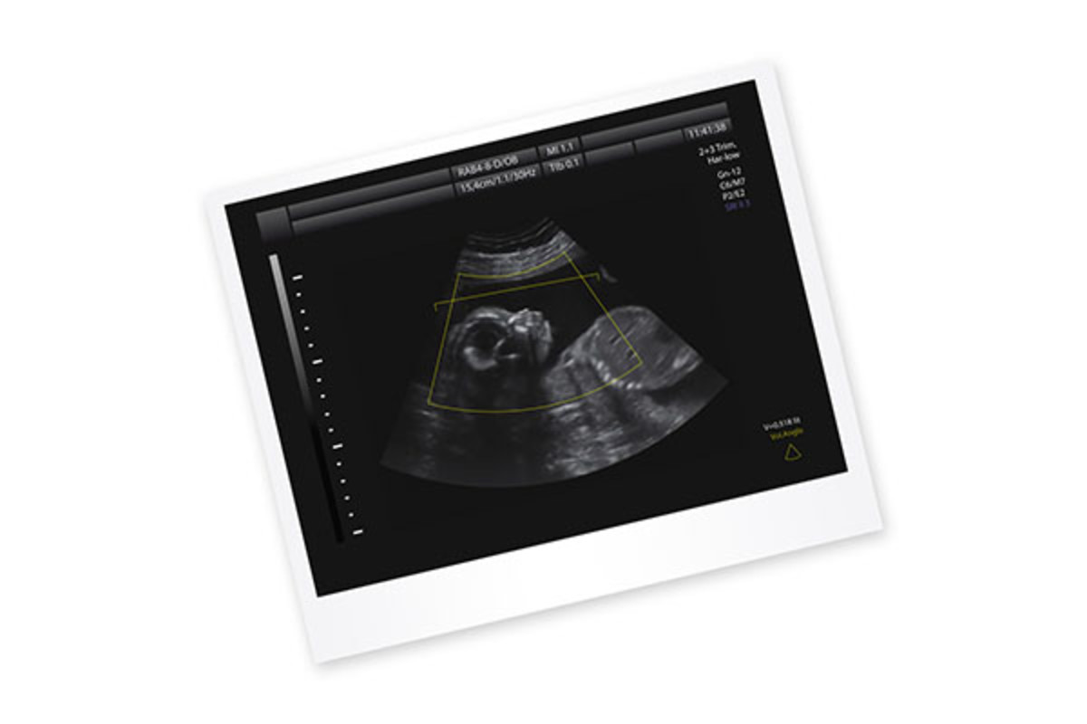 An ultrasound. (PHOTO: VALENTINA RAZUMOVA/SHUTTERSTOCK)