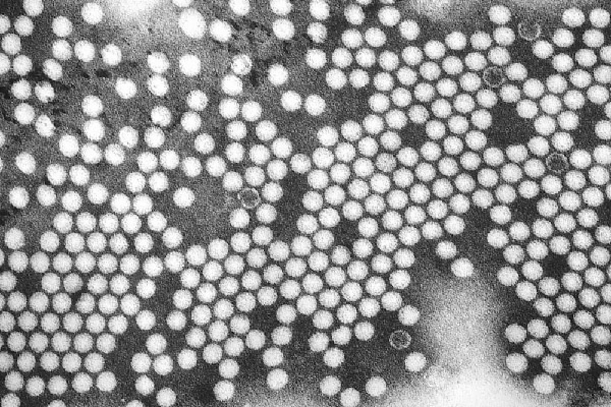 A TEM micrograph of poliovirus. (PHOTO: PUBLIC DOMAIN)