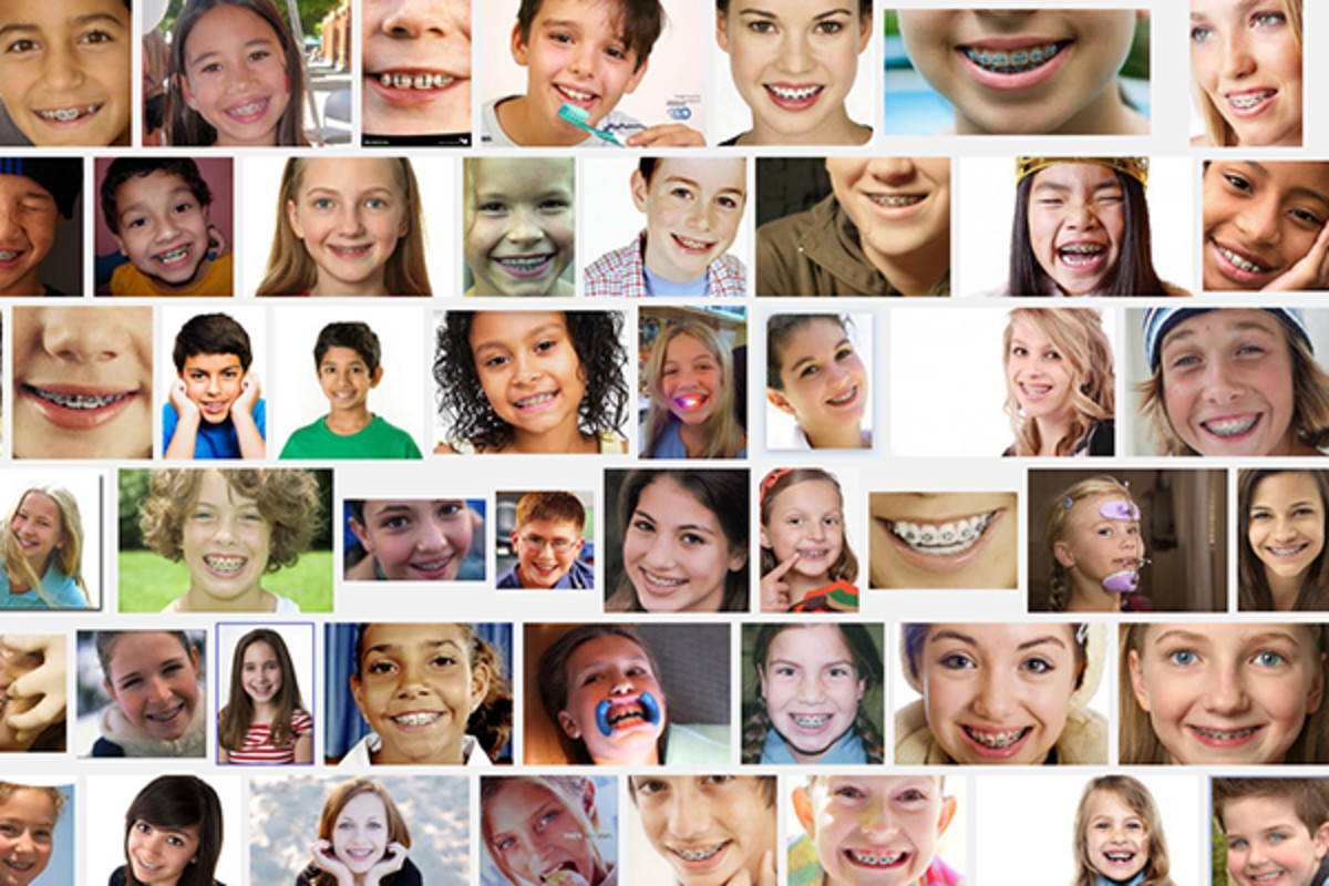 Results for a Google Image search for "child with braces." (PHOTO: COURTESY OF GOOGLE)
