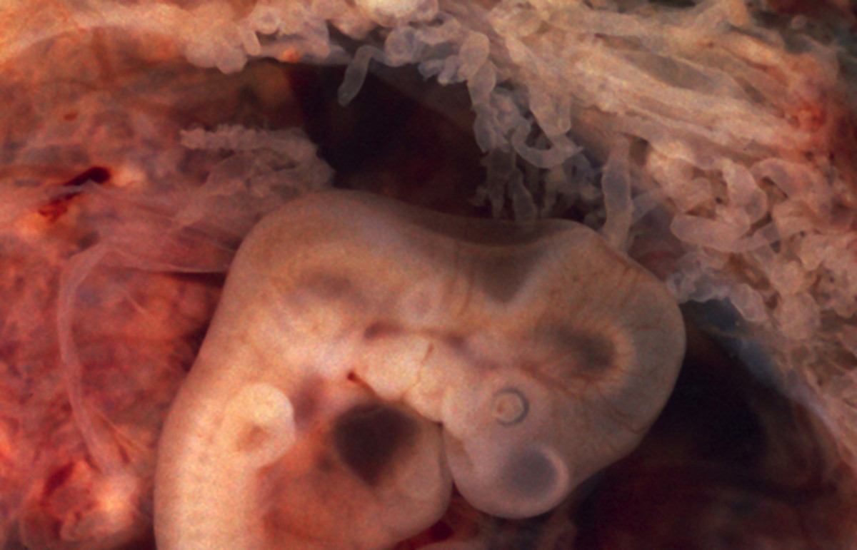A human embryo that's about five weeks old. (Photo: Public Domain)
