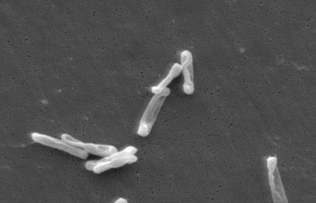 Individual, drumstick-shaped C. difficile bacilli seen through scanning electron microscopy. (Photo: Public Domain)
