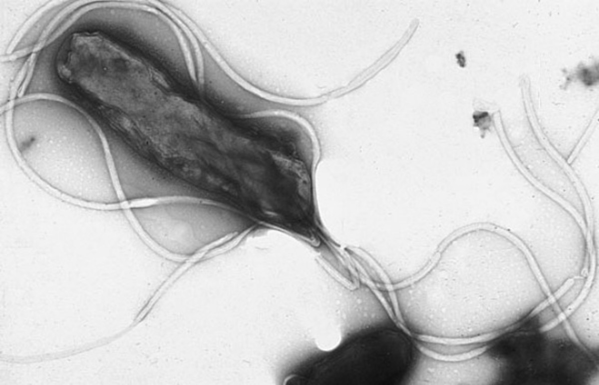 Helicobacter pylori. (Photo: Wikimedia Commons)