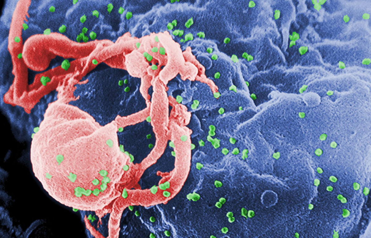 Scanning electron micrograph of HIV-1 budding (in green) from cultured lymphocyte. (Photo: Public Domain)