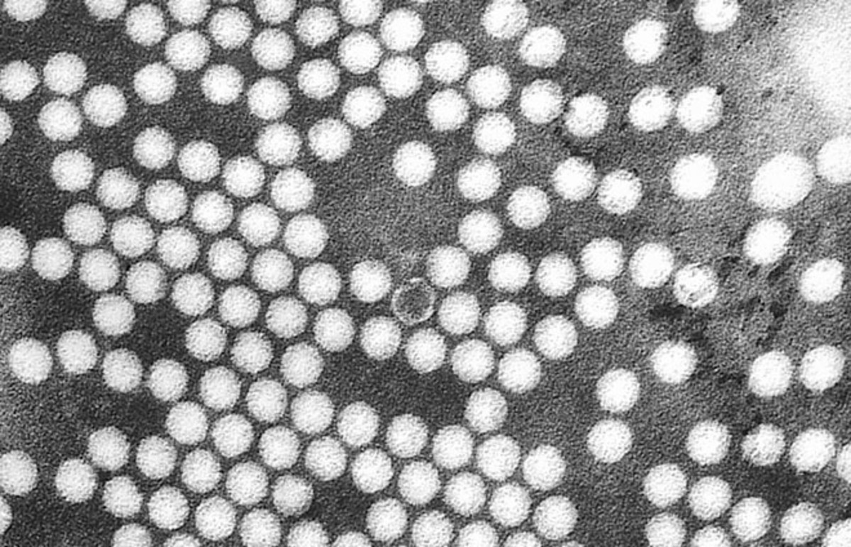 A TEM micrograph of poliovirus. (Photo: Public Domain)