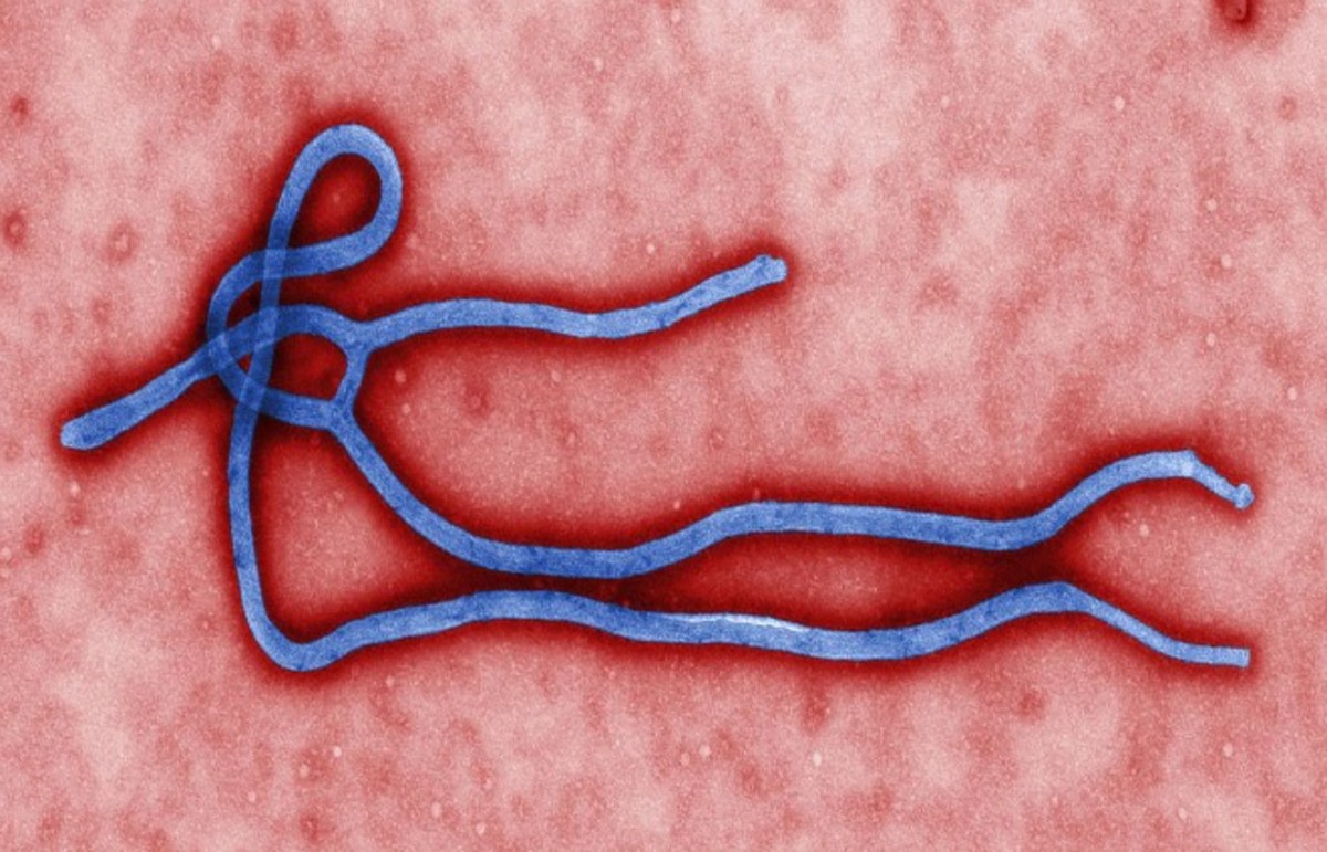 Ebola virus virion. (Photo: Public Domain)