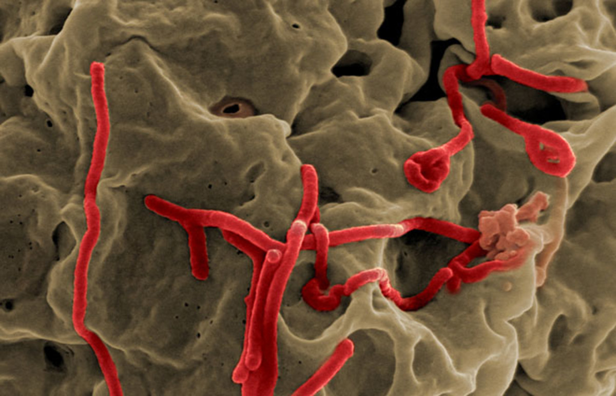 Ebola virus. (Photo: NIAID/Flickr)