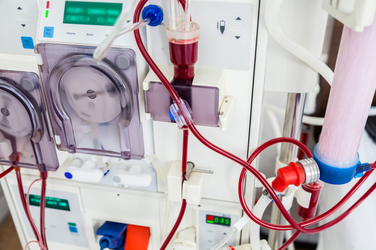 Dialysis device. (Photo: beerkoff/Shutterstock)