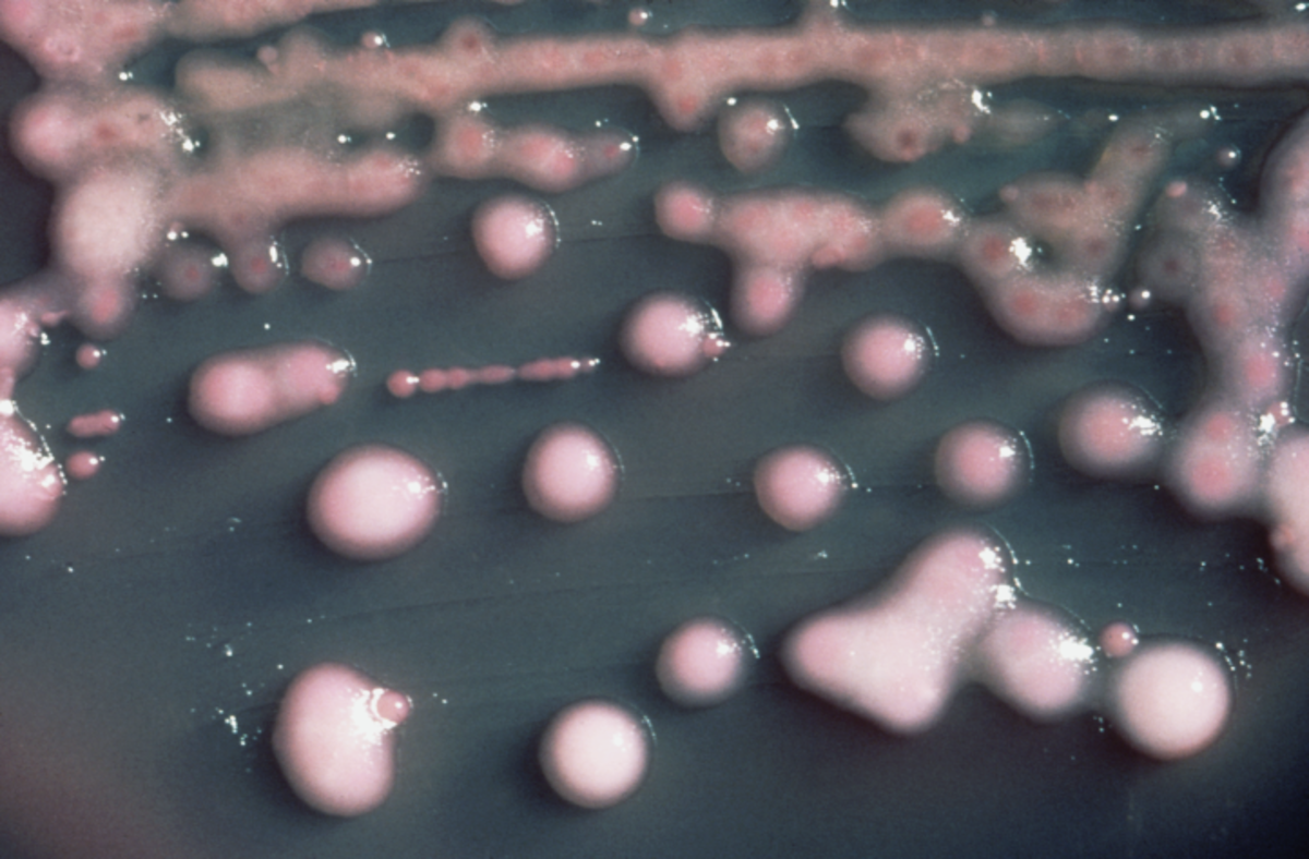 Klebsiella pneumoniae, the bacterium in which NDM-1 was first identified. (Photo: Public Domain)