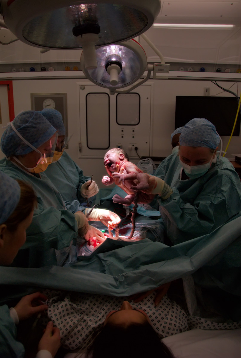 A team of obstetricians performing a Caesarean section in a modern hospital. (Photo: Salim Fadhley/Wikimedia Commons)