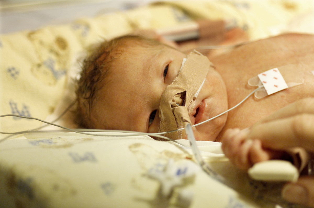 Premature baby boy delivered by Caesarean section. (Photo: Steve Lovegrove/Shutterstock)