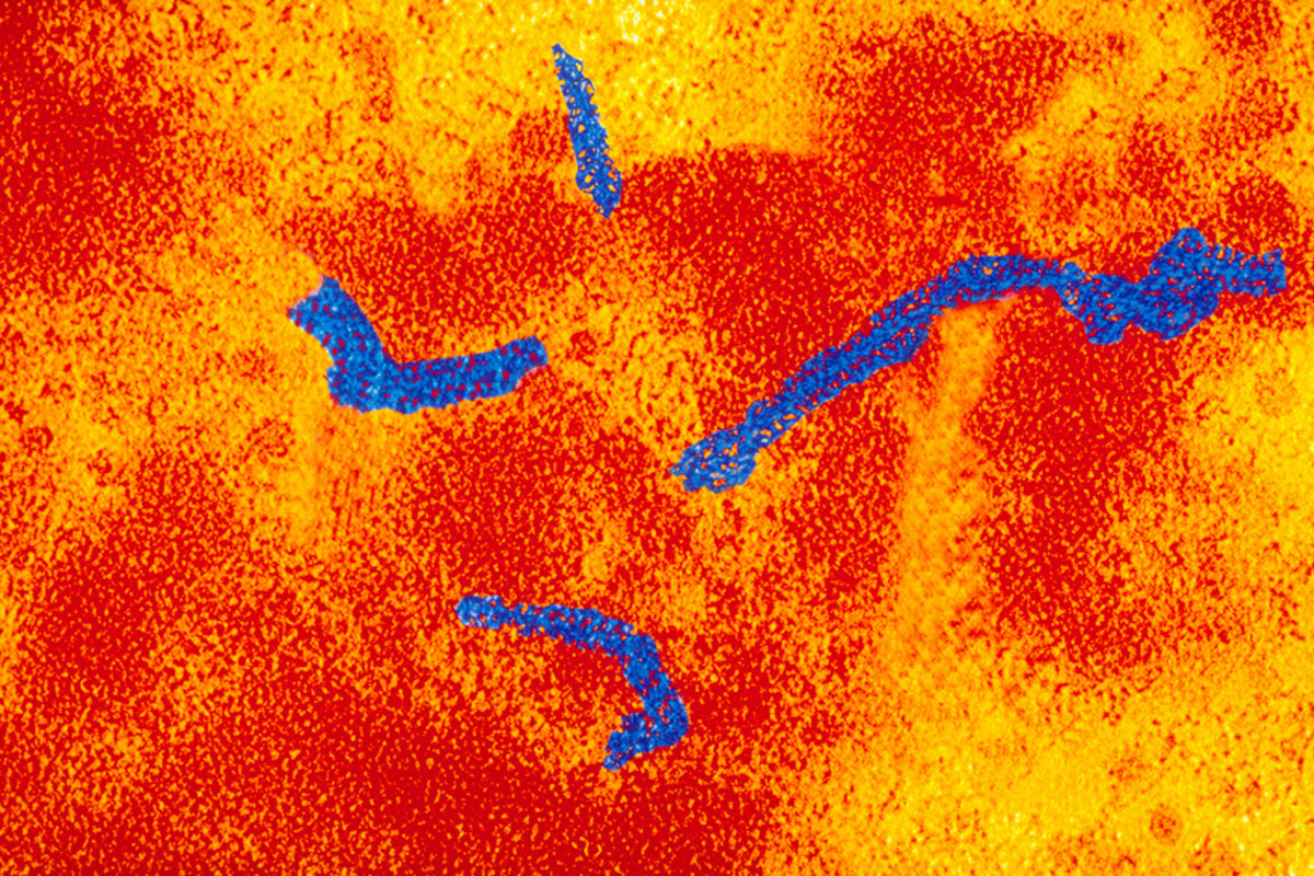 The measles virus under the microscope. (Photo: sanofi-pasteur/Flickr)