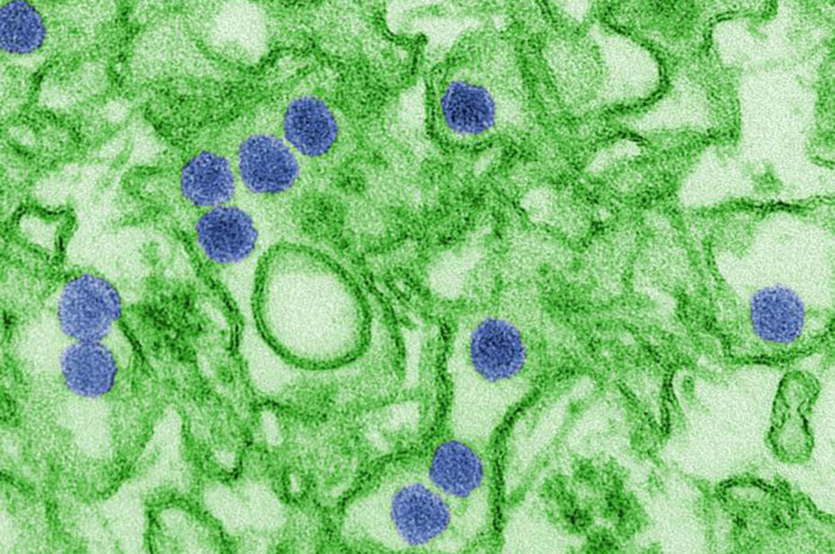 Zika virus. (Photo: Cynthia Goldsmith/CDC)