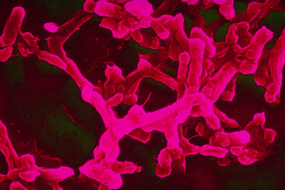 Salmonella typhi. (Photo: Sanofi Pasteur/Flickr)
