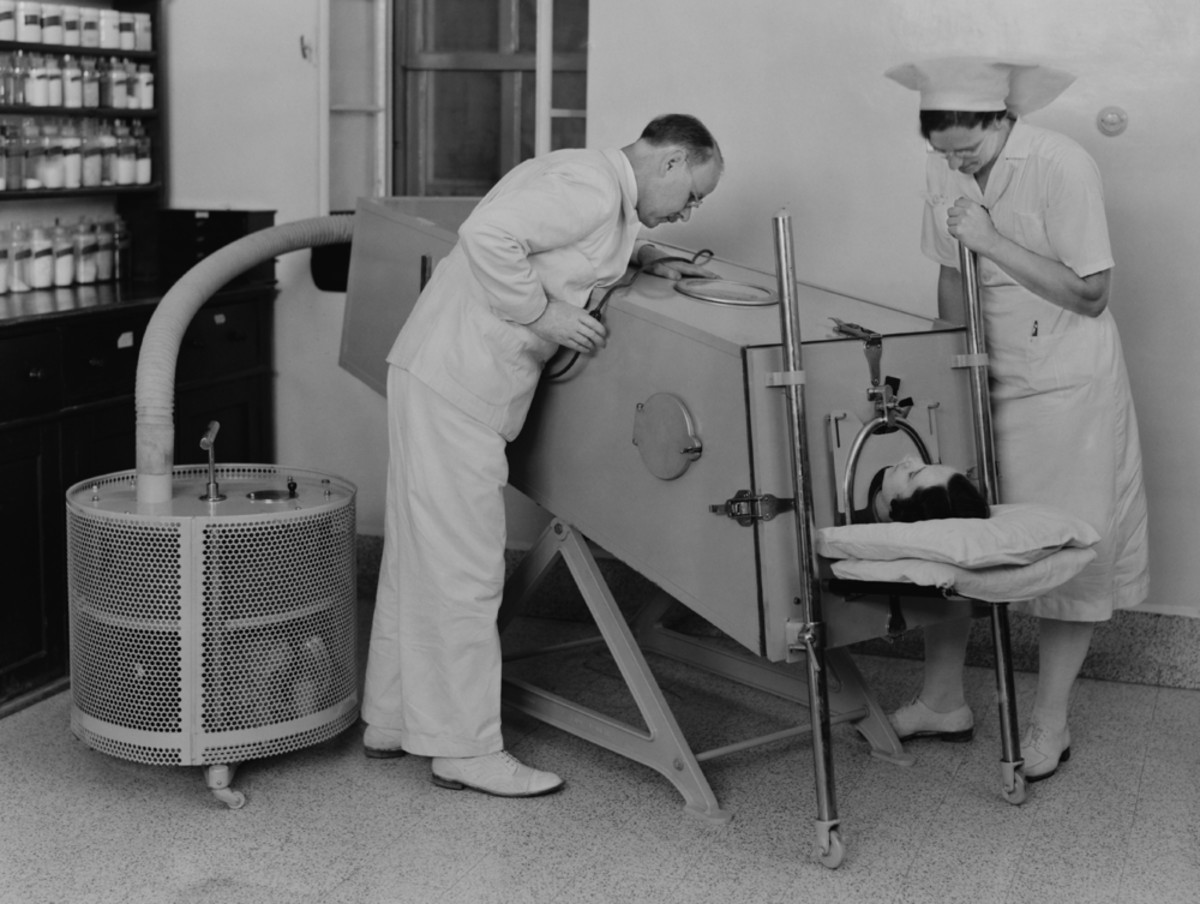 A polio patient in an iron lung at the Scots Mission Hospital in Tiberias, Palestine, in March 1940. (Photo: Everett Historical/Shutterstock)