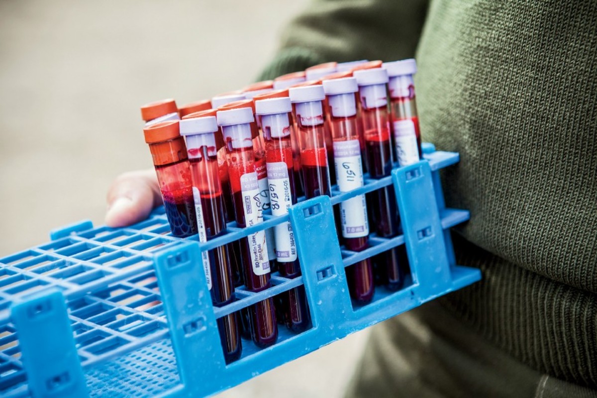 Bison-blood samples taken by Yellowstone park biologists for brucellosis testing. Brucellosis causes cows to abort, and bison are being blamed for spreading the disease among cattle, even though there has never been a recorded case of transmission from wild bison to cows.