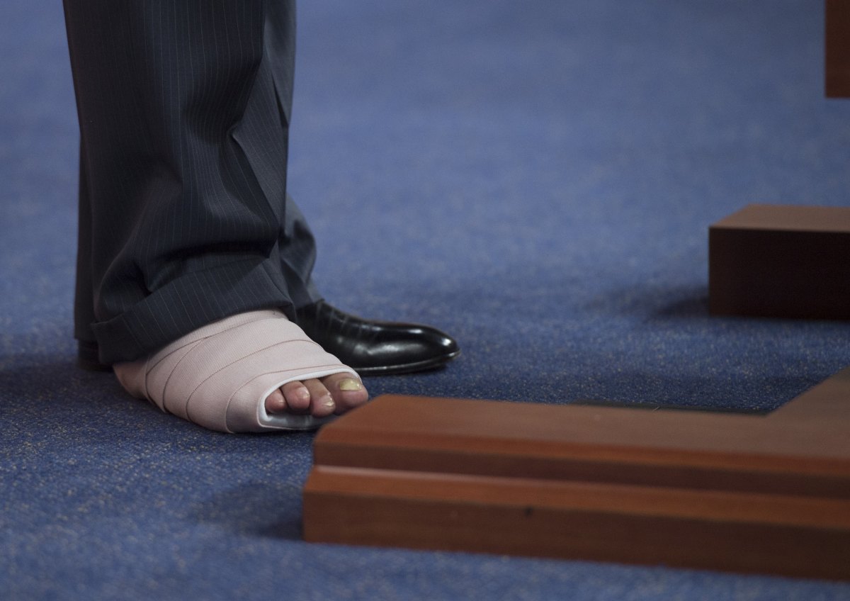 A photograph of Representative Roger Williams' (R–Texas) foot. Williams sustained an injury when he was forced to dive for cover from a gunman who opened fire on the Republican congressional baseball team in Arlington, Virginia, on June 14th, 2017.