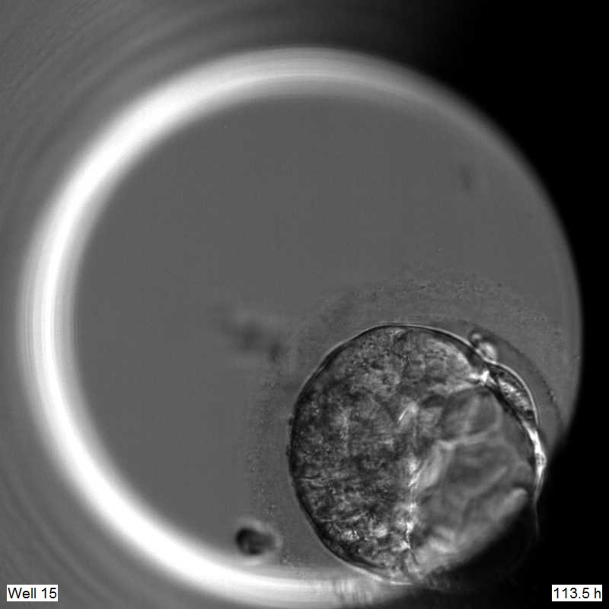 A five-day-old embryo from the lab.