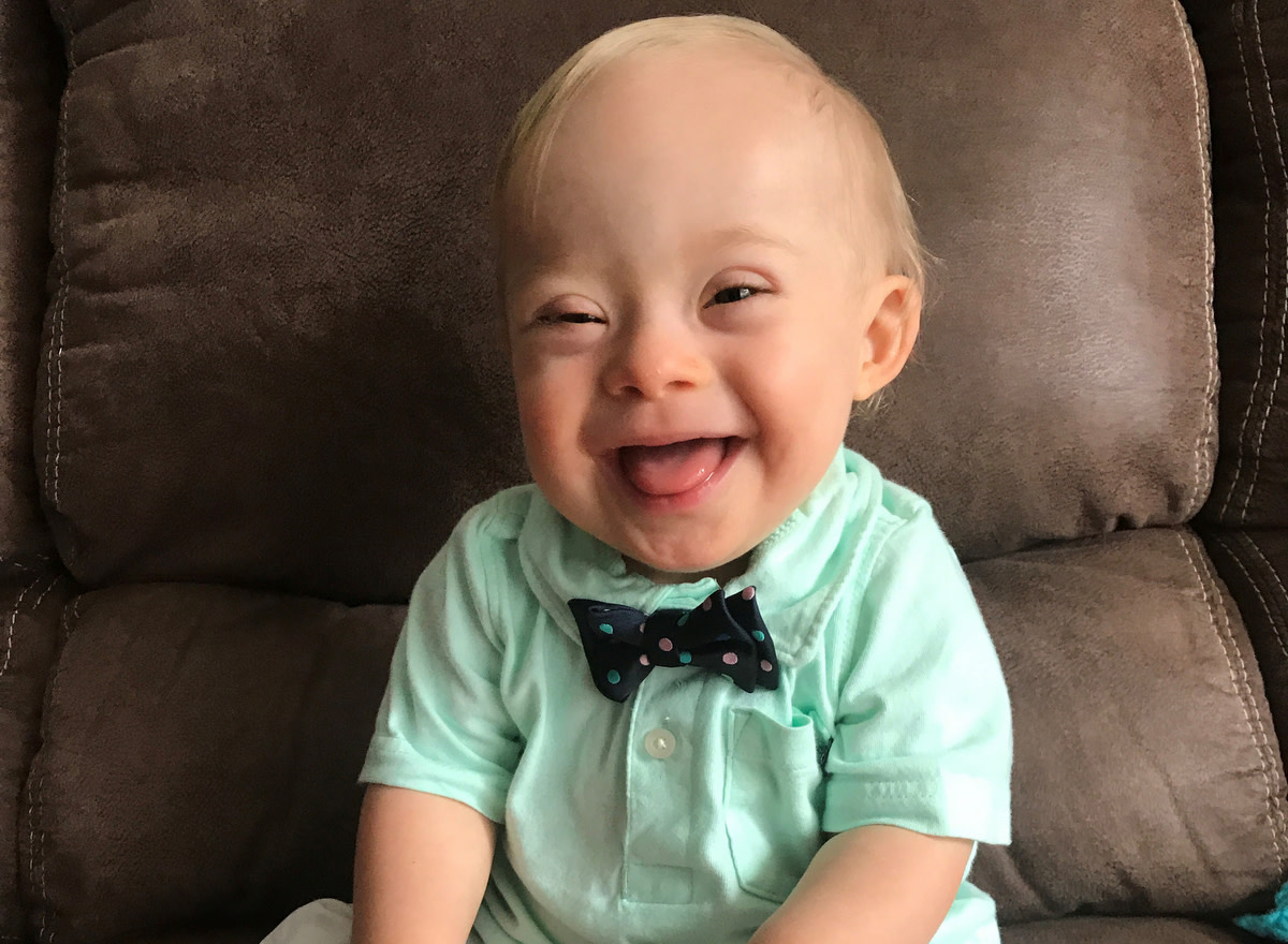 Gerber's New Spokesbaby Has Down Syndrome. So What ...