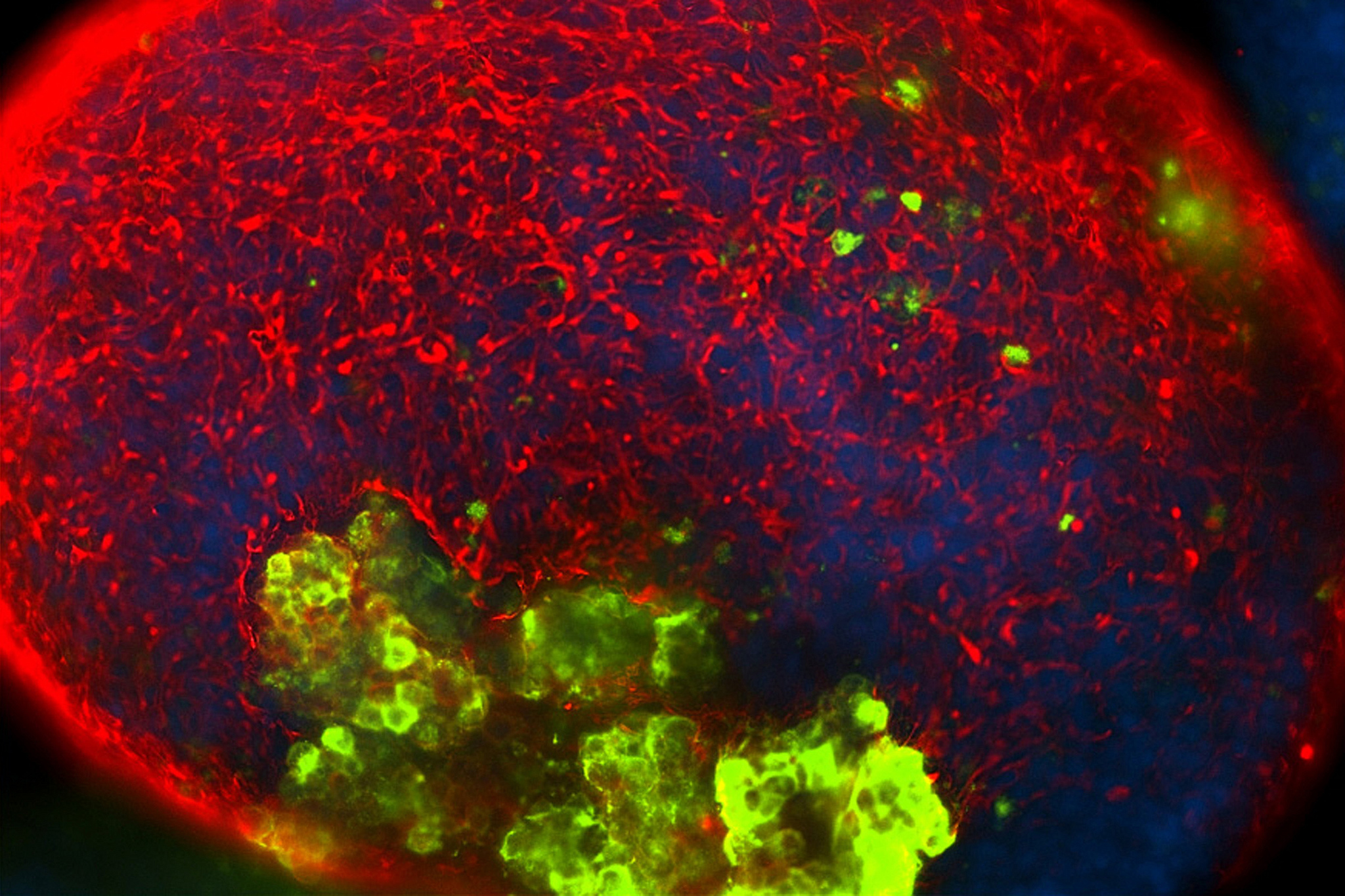How Scientific Progress Is Changing the Stem Cell Debate