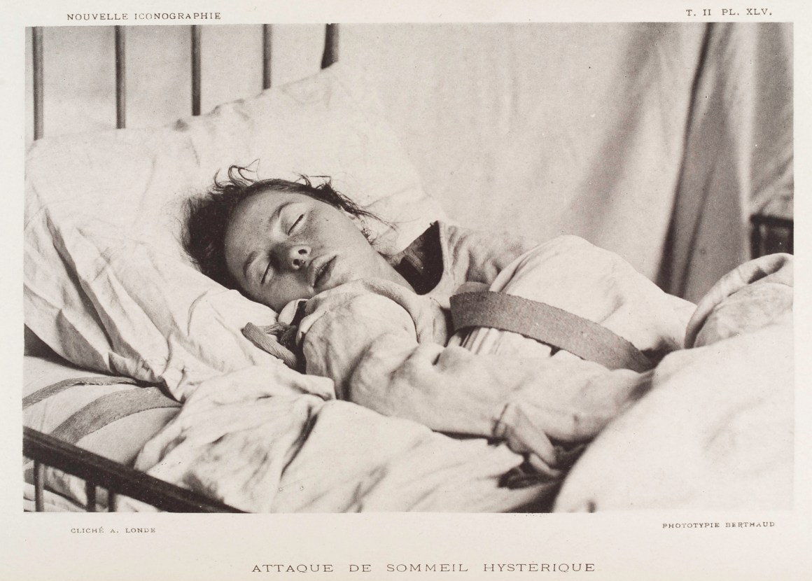 sleep hysteria albert londe