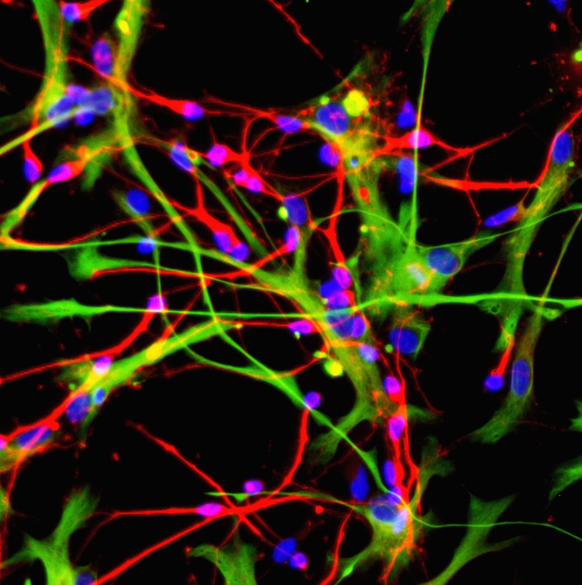 Neurons (red) and astrocytes (green), developed from stem cells.