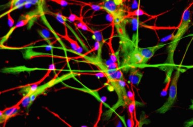 Neurons (red) and astrocytes (green), developed from stem cells.