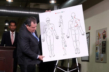 Attorney Brian Panish with image showing gunshot wounds to Stephon Clark in Sacramento, California.