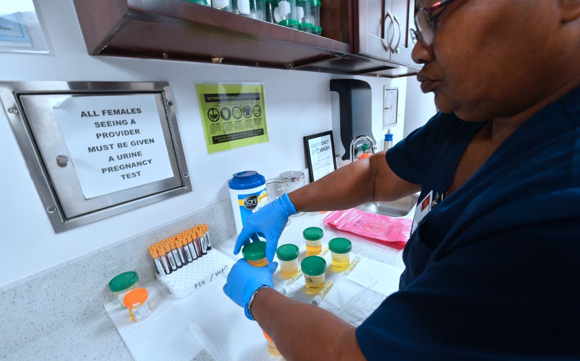 A medical assistant closes bottles of patients' urine submitted for STD testing in Hollywood, California, on May 18th, 2018.