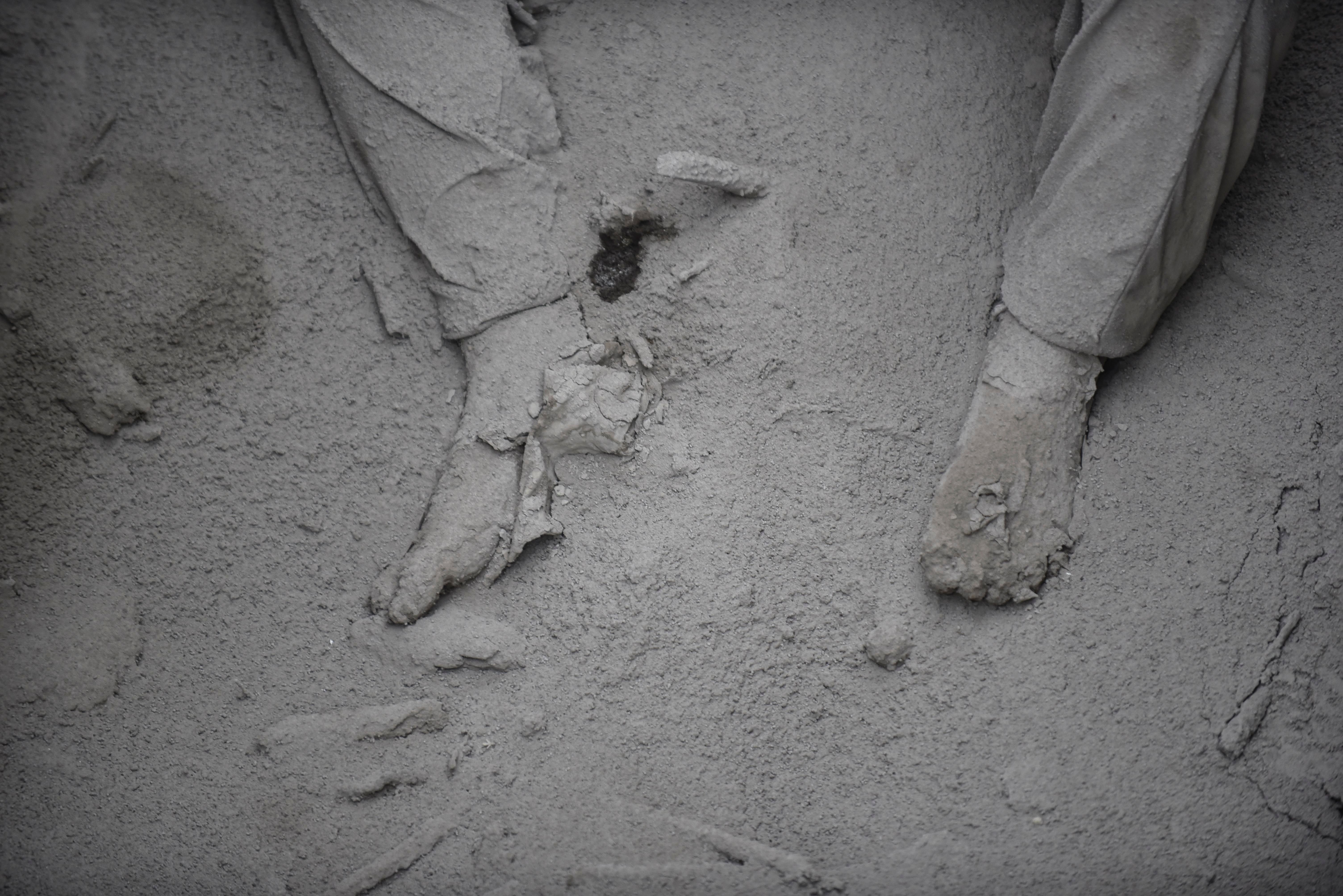 Partial view of a victim of the Fuego volcano in San Miguel Los Lotes, a village in Escuintla, about 35 kilometers southwest of Guatemala City, taken on June 4th, 2018, a day after the eruption.