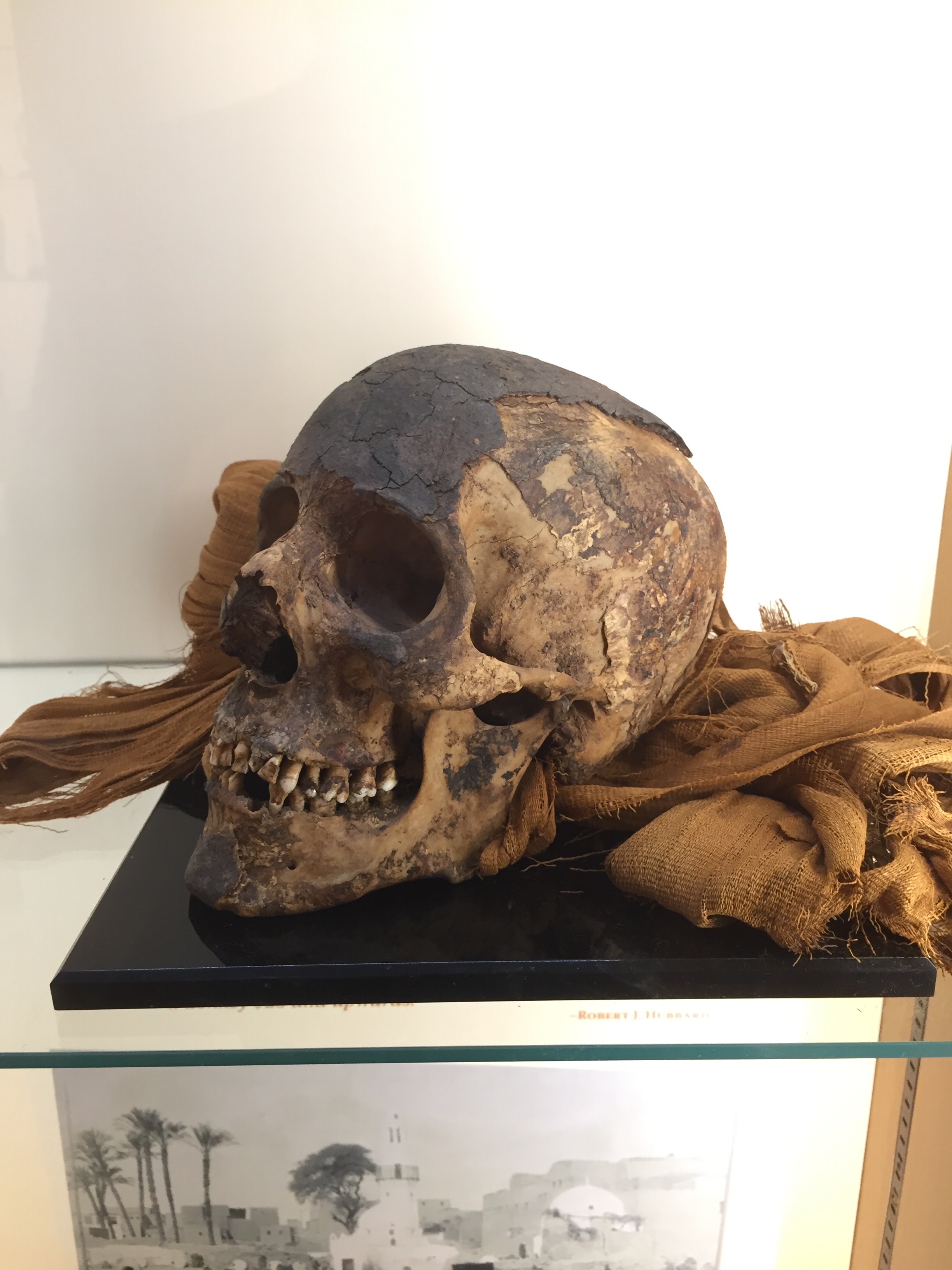 A mummified head, unwrapped, part of the Cazenovia Public Library's Exploring Egypt exhibit.